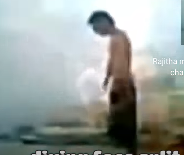 vidéo de l'accident de l'attelle faciale en 2009 sur Reddit, Twitter