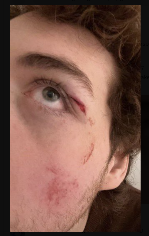 Dream Getting Beat Up By Gumball