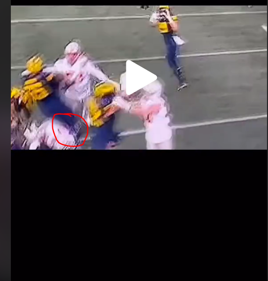 Zak Zinter Leg Injury Update Today: Video and Latest News