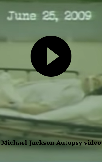Michael Jackson Autopsy Photo