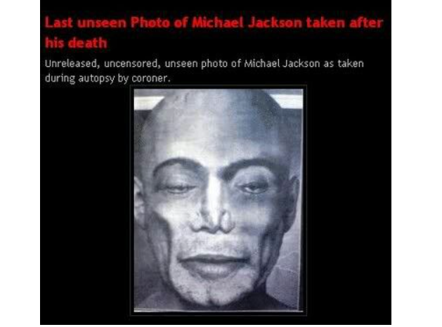 Michael Jackson Autopsy Photo