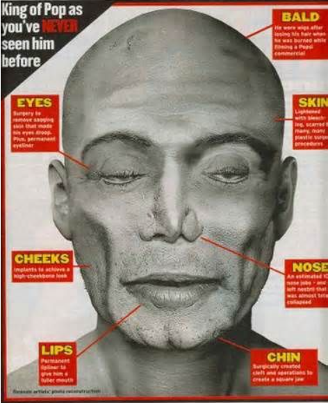 Michael Jackson Autopsy Photo