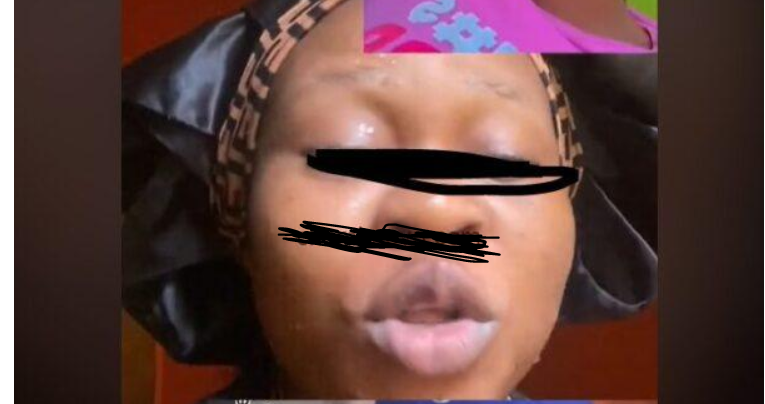 Trending Hannah Yansh Infection Video